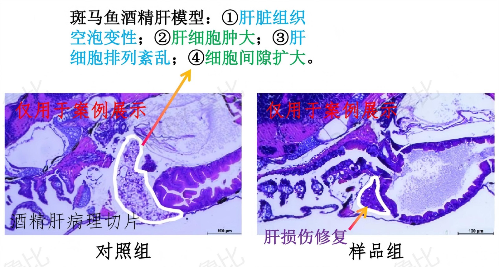 斑马鱼酒精肝模型