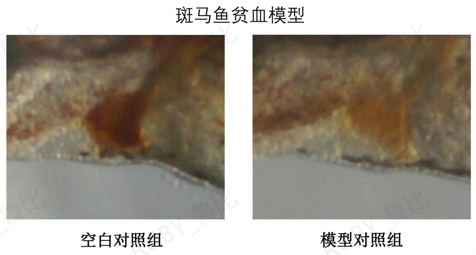 改善缺铁性贫血